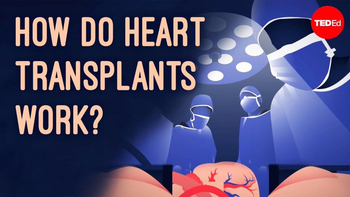 How does heart transplant surgery work? roni shanoada