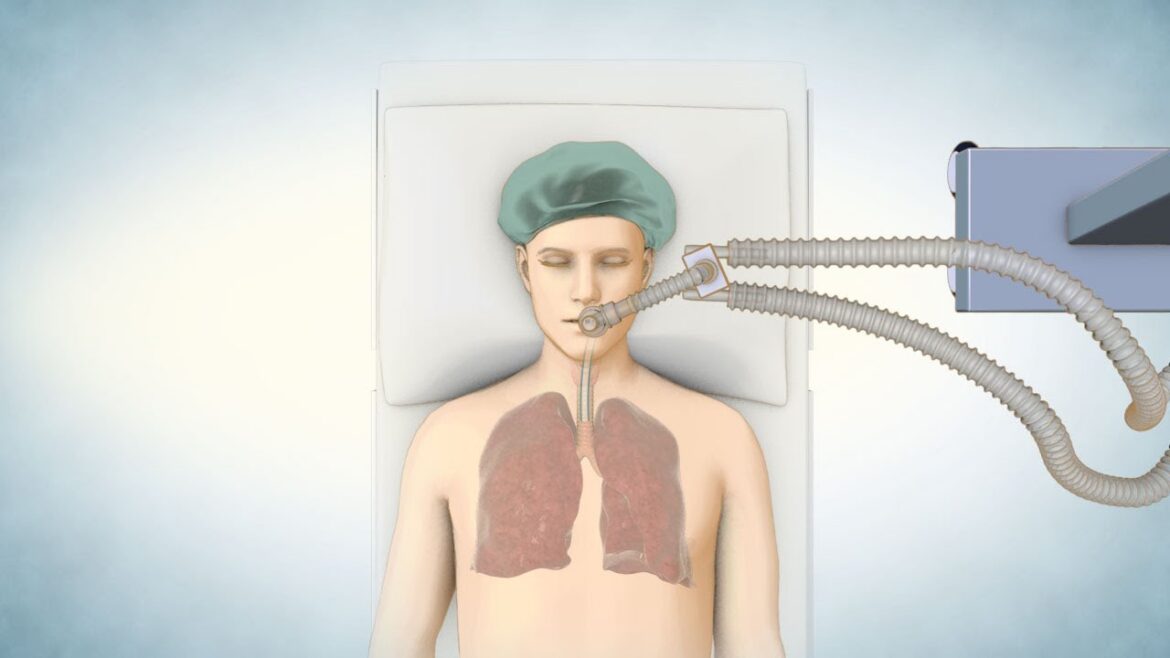 Lung Transplant Process