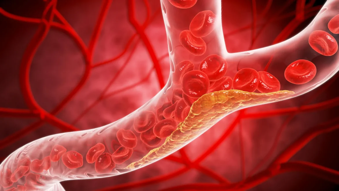 New cholesterol guidelines could change when you get tested.webp.webp