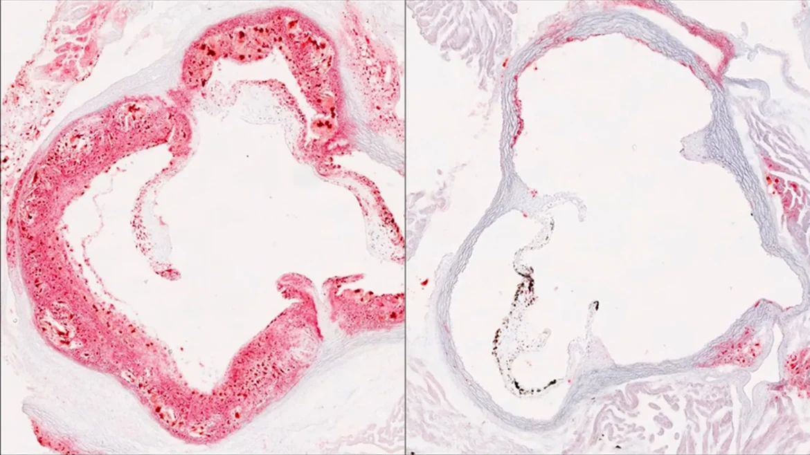 Scientists discover hidden liver switch that cuts harmful cholesterol.webp.webp