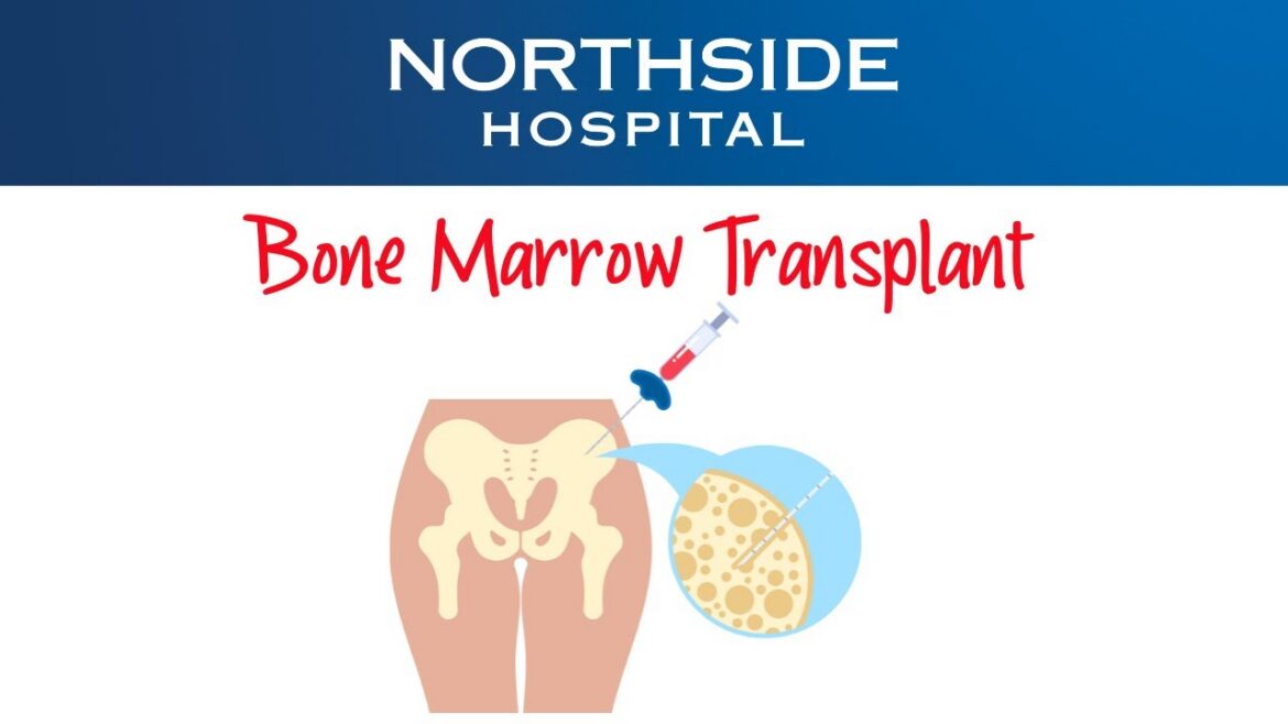 What You Need to Know About Bone Marrow Transplants