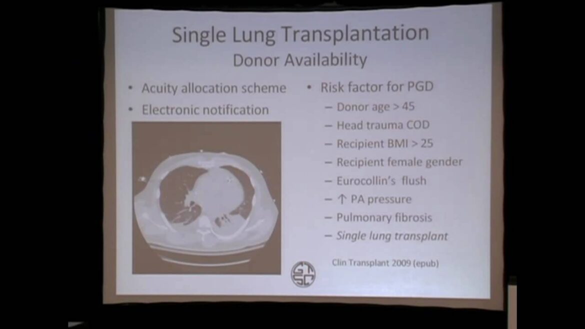 John Wain Single Lung Transplantation (PART 2 of 2)
