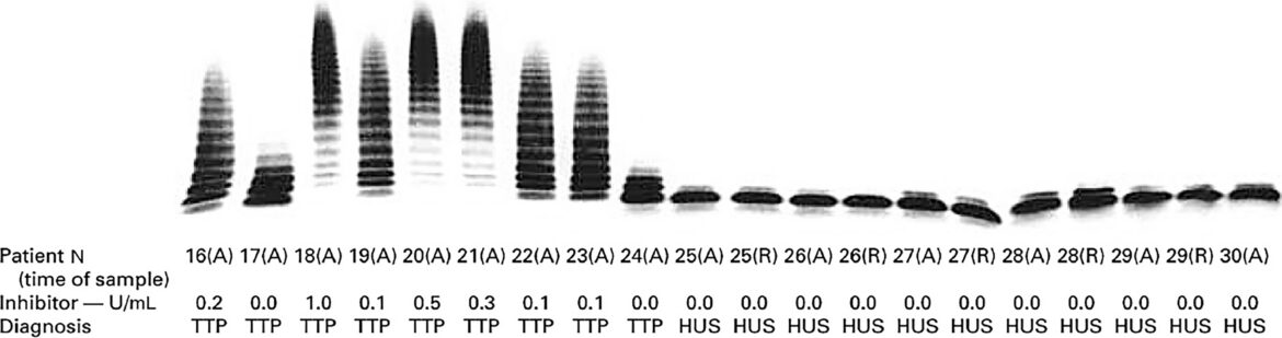 Von Willebrand factor cleaving protease ADAMTS 13.jpeg