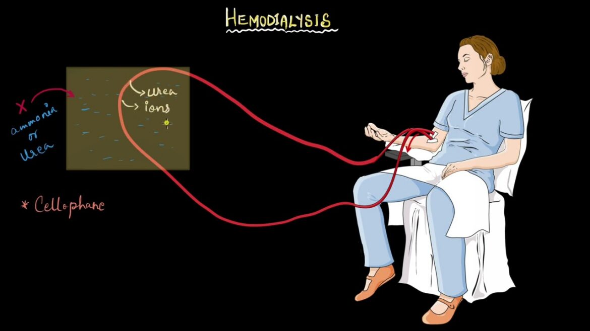 Hemodialysis | Excretory products and their elimination | Biology |