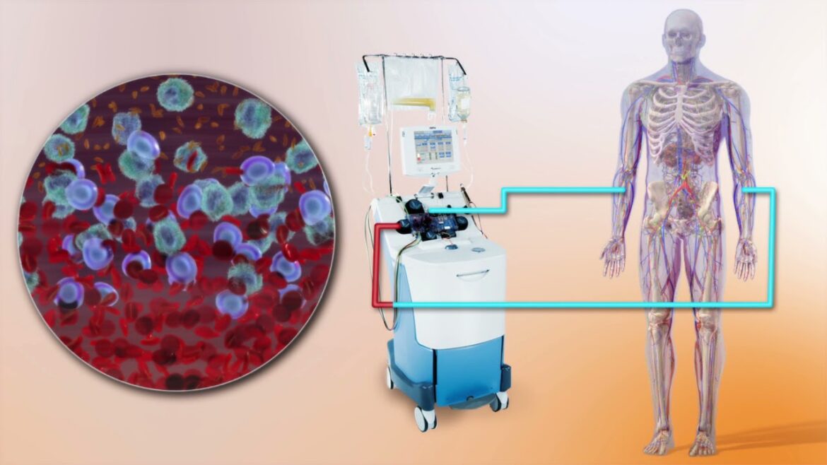 Myeloma UK Autologous stem cell transplantation
