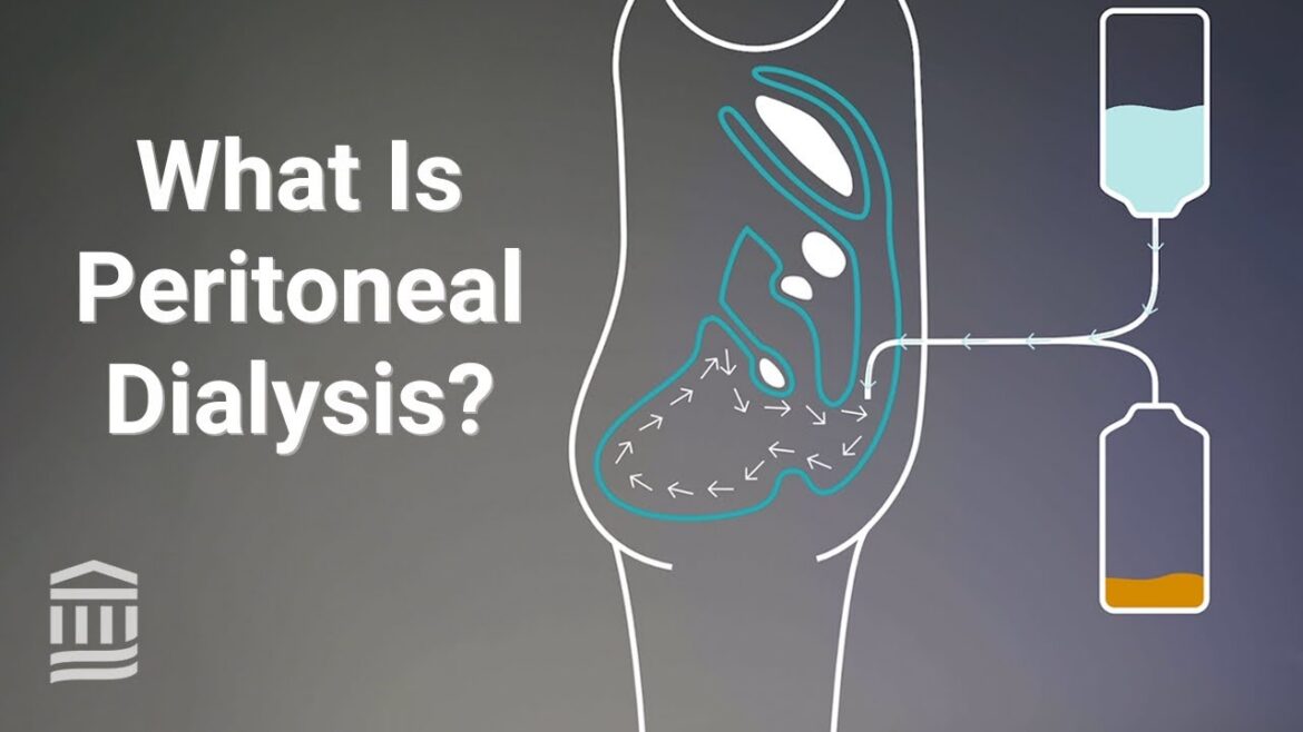 Peritoneal Dialysis: At Home Treatment for Kidney Failure | Mass