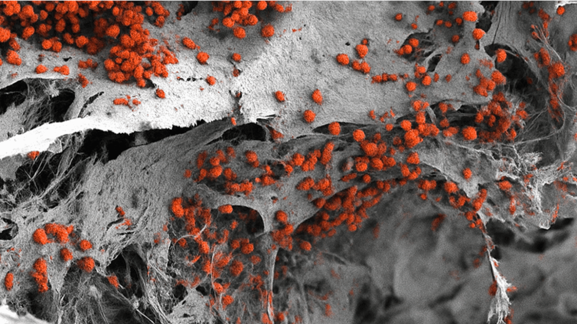 Bone marrow model.png